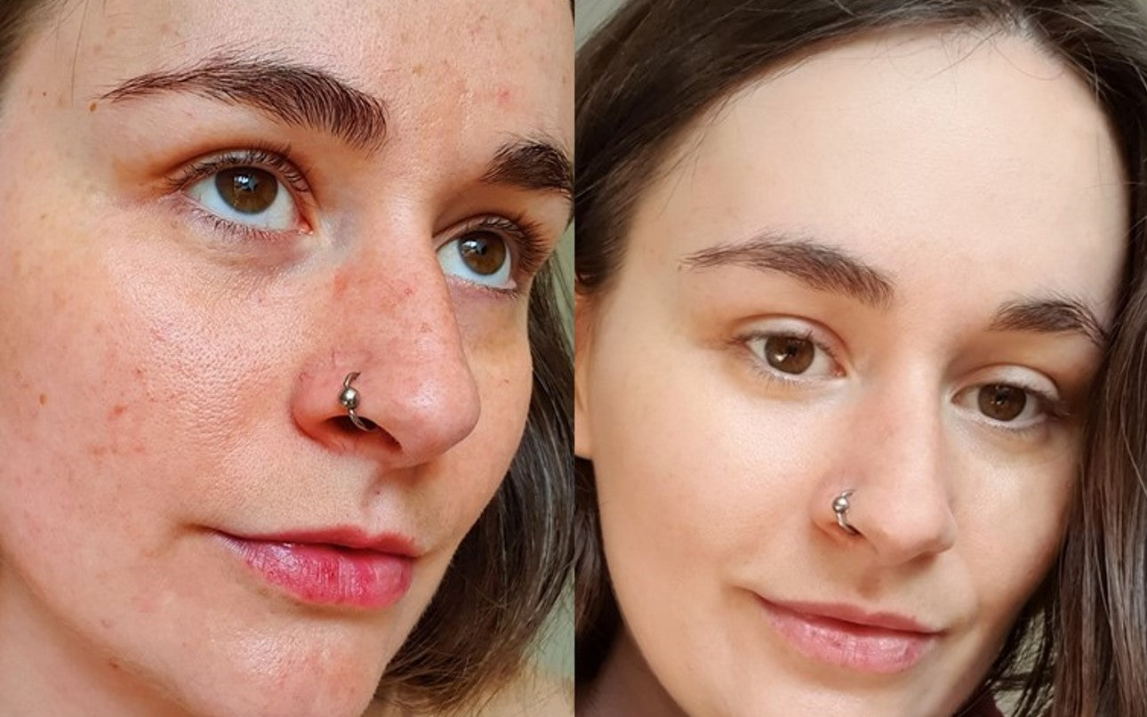 UpCircle glow ups