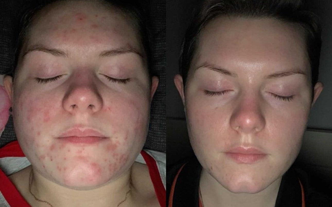 See it to believe it: UpCircle skin transformations