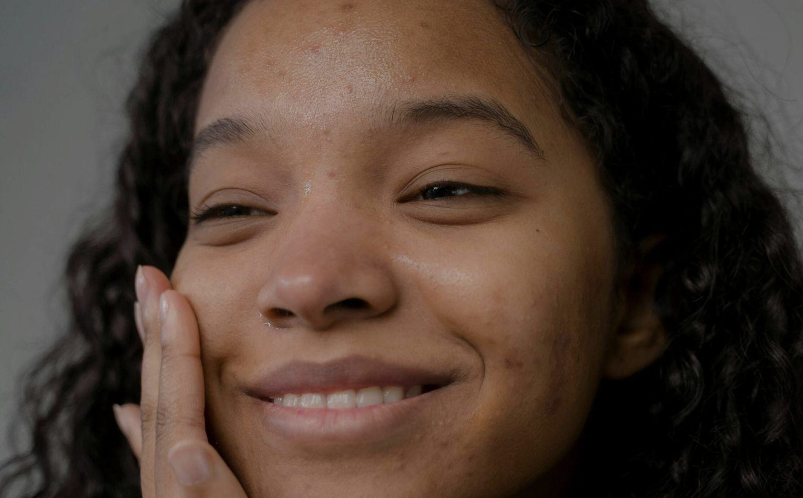 uneven skin tone and texture