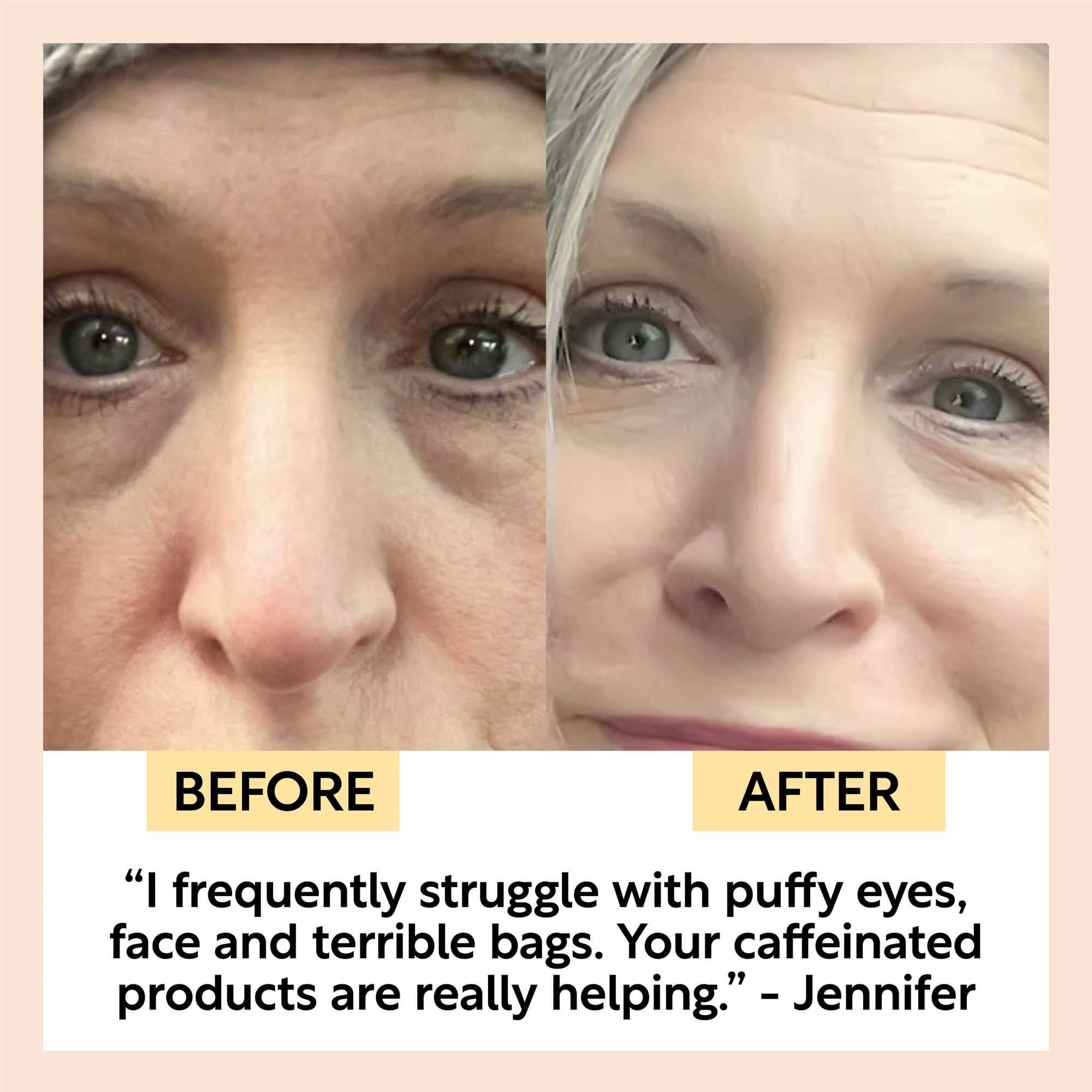 Eye Cream with Hyaluronic Acid + Coffee