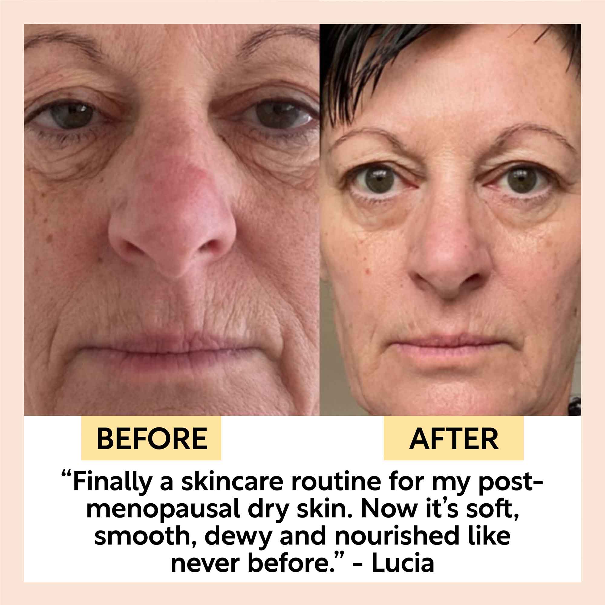 Eye Cream with Hyaluronic Acid + Coffee
