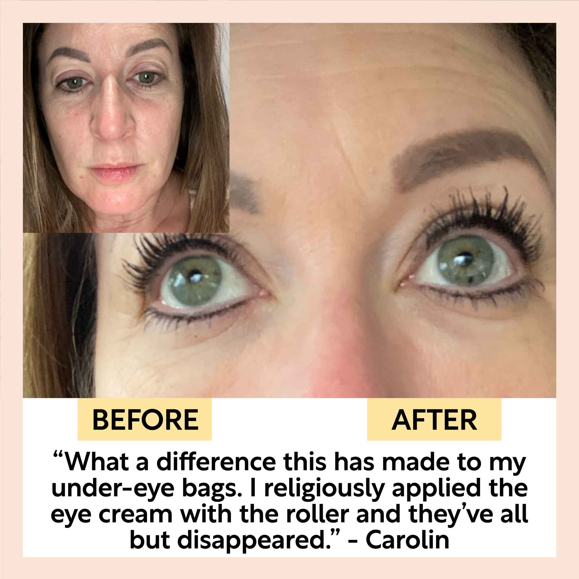 Eye Cream with Hyaluronic Acid + Coffee